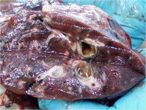 deer fluke liver is a parasite that would keep us from eating deer liver